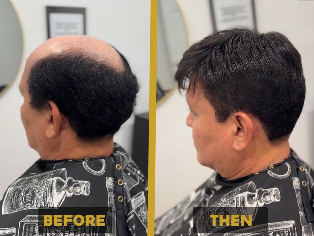 Natural Hairline
